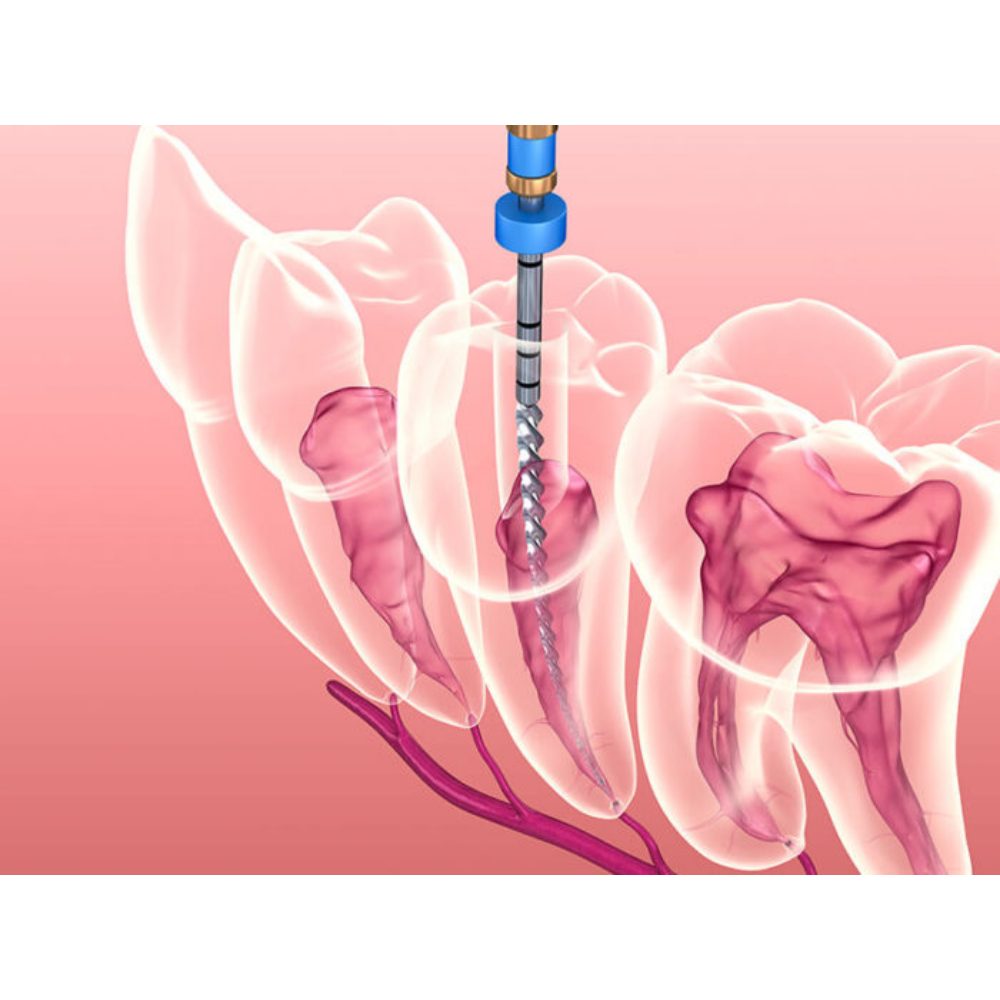 Endodontia